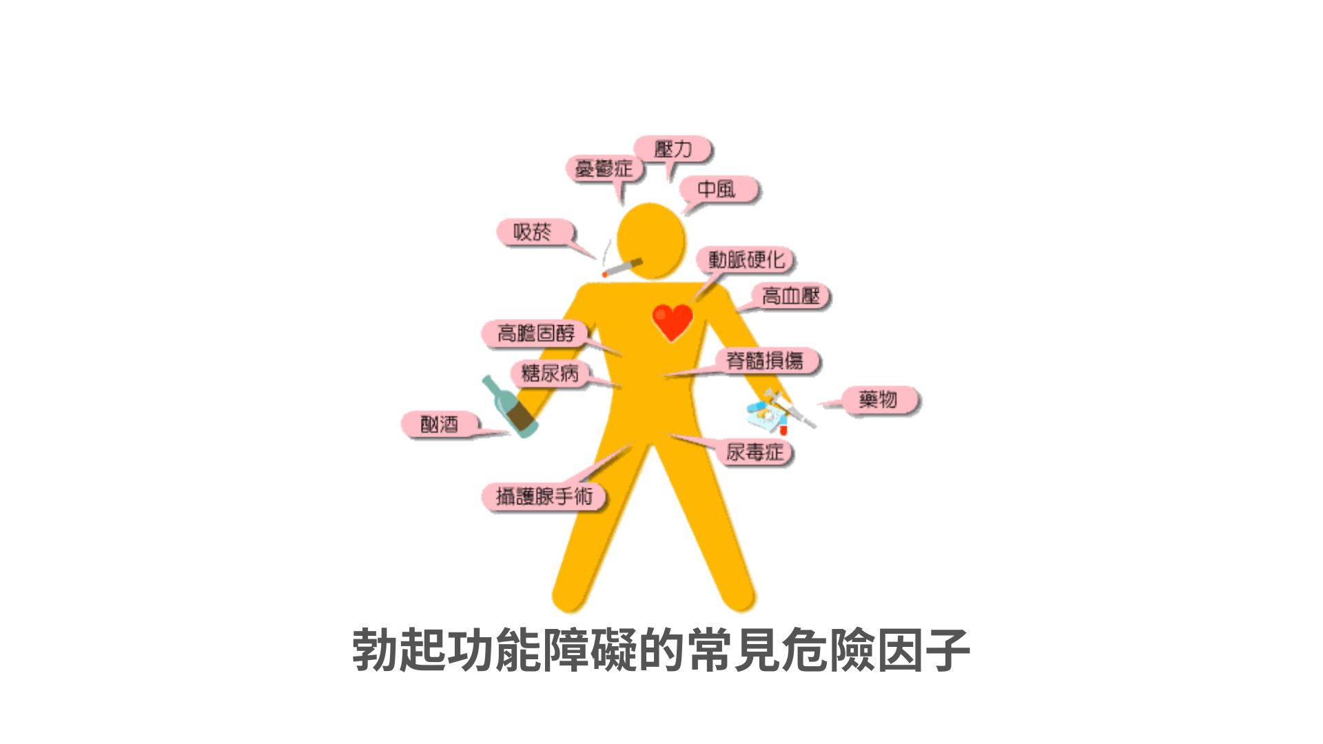 一張衛教資訊圖表，透過人體輪廓圖詳細標示出包含壓力、吸菸、高血壓及糖尿病等導致勃起功能障礙的多項常見危險因子。